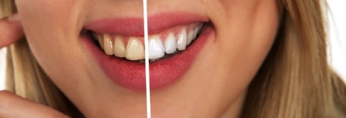 Cosmetic Dentistry Procedures