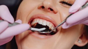 A healthy smile during a dental check-up at Dr. Molly Rodgers Edmonton Dentist clinic.