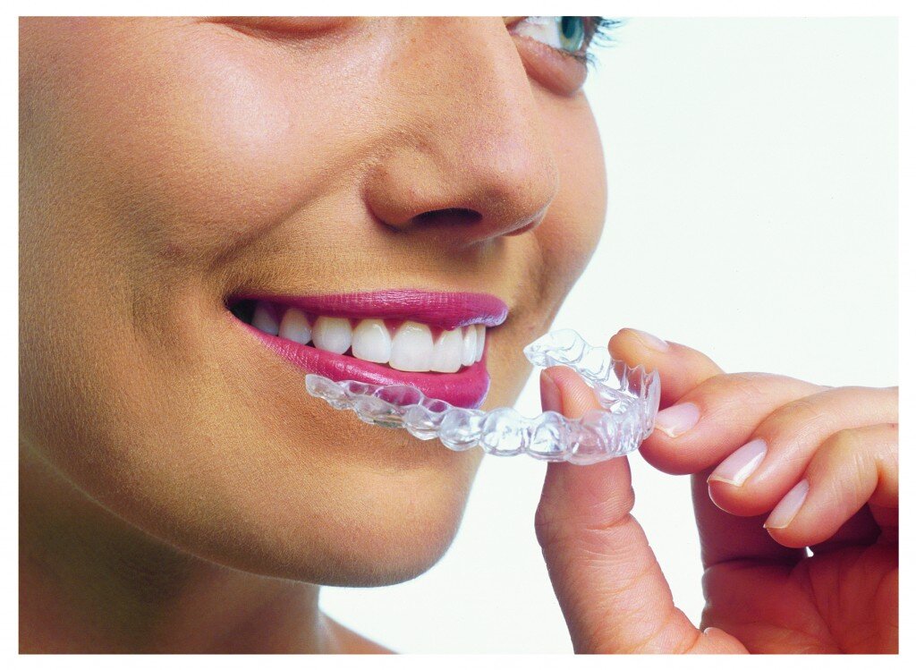 Teeth Whitening Edmonton