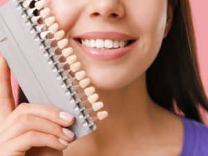 choosing the right shade for veneers