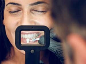 Methods-for-Keeping-Your-Veneers-Looking-Like-New