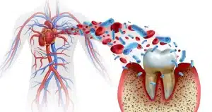 Oral Health and Heart Disease Are Connected