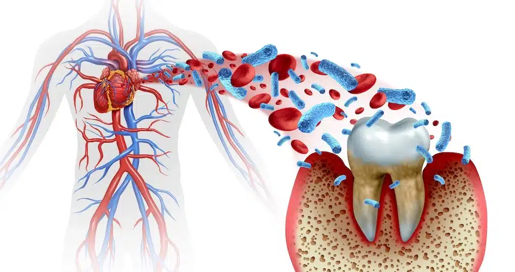 Oral Health and Heart Disease Are Connected
