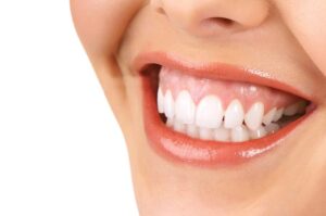 gummy-smile-treatment-admonton