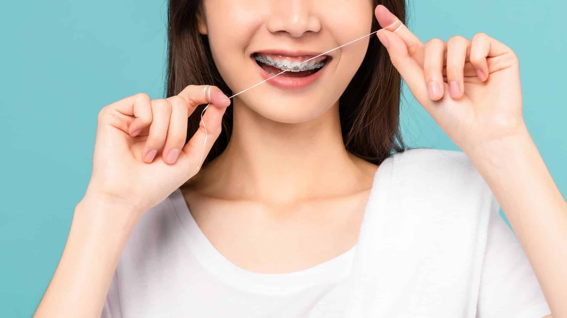 How to Floss with Braces or Bridges_ A Step-by-Step Guide
