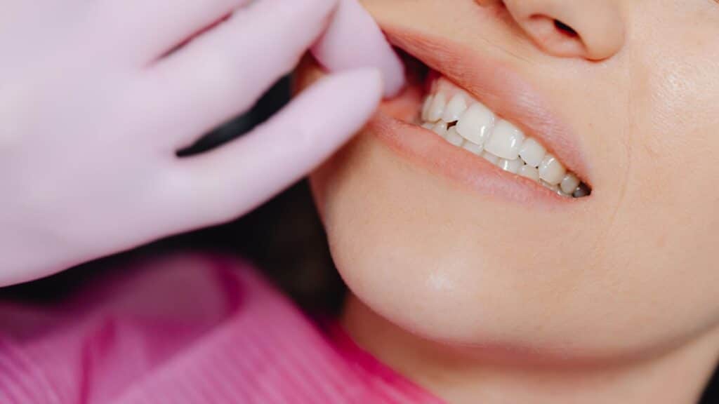 Tooth Sensitivity After Filling_ Learn Why It Happens and What to Do