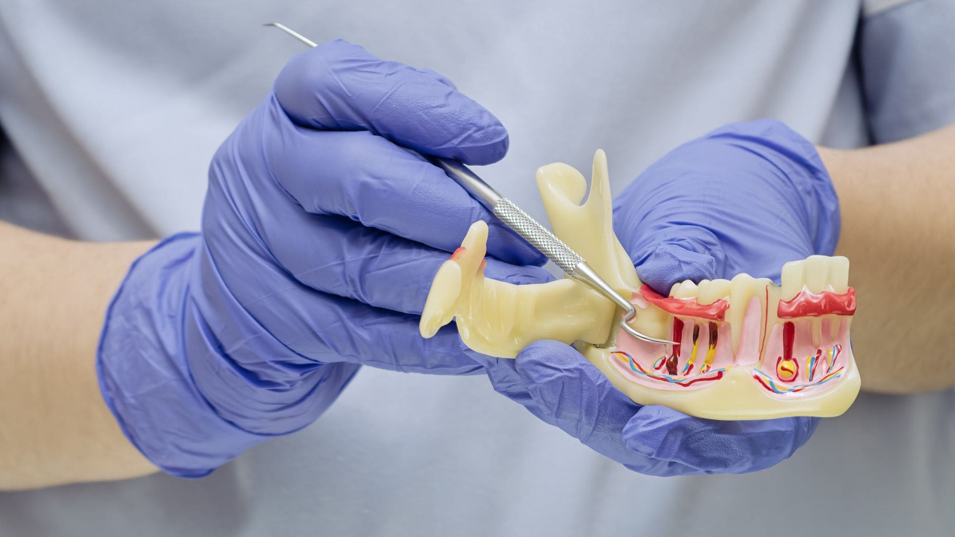 - What Are Periodontal Pockets? Signs, Causes, And Treatment Options