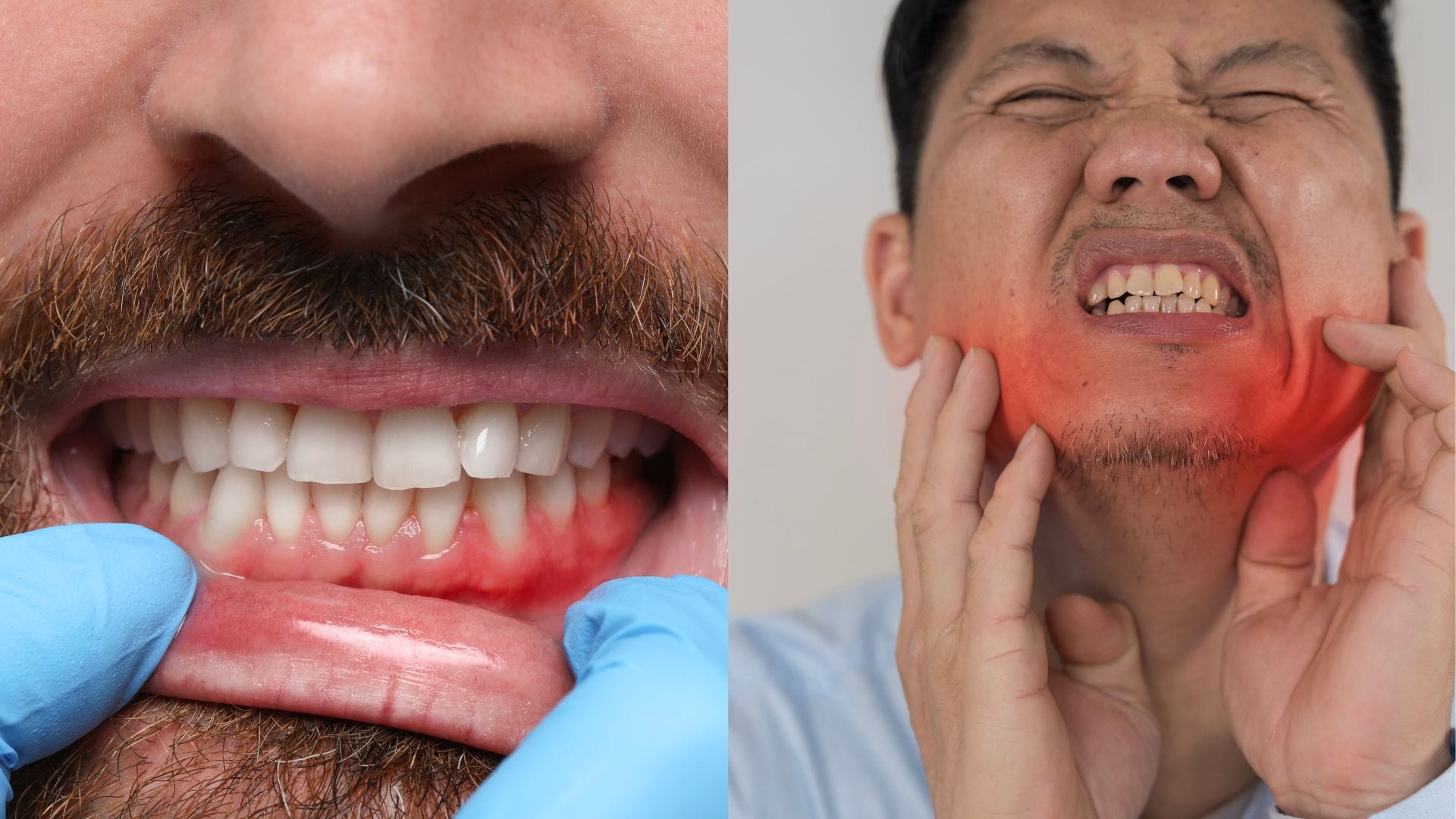 Gum Inflammation vs Infection: Key Differences, Symptoms, and When to See a Dentist