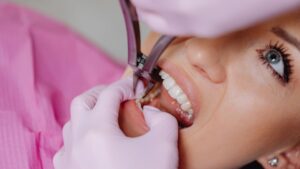 How Long Does a Root Canal Last? Signs It May Need Replacement