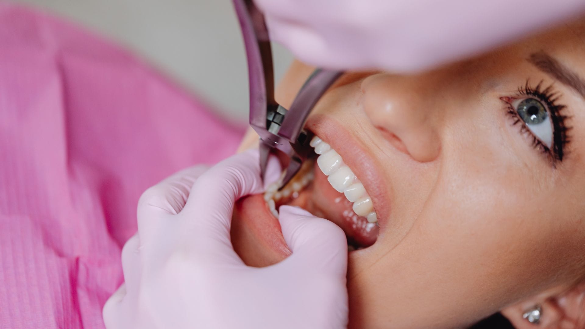 How Long Does a Root Canal Last? Signs It May Need Replacement