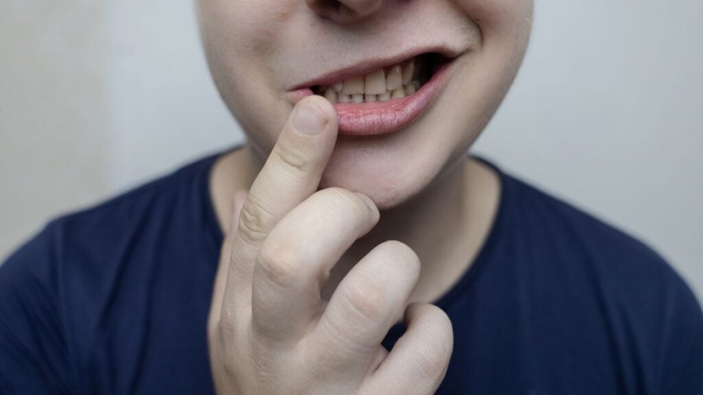How To Fix Facial Asymmetry From Chewing On One Side Naturally And Effectively