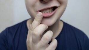 How To Fix Facial Asymmetry From Chewing On One Side Naturally And Effectively