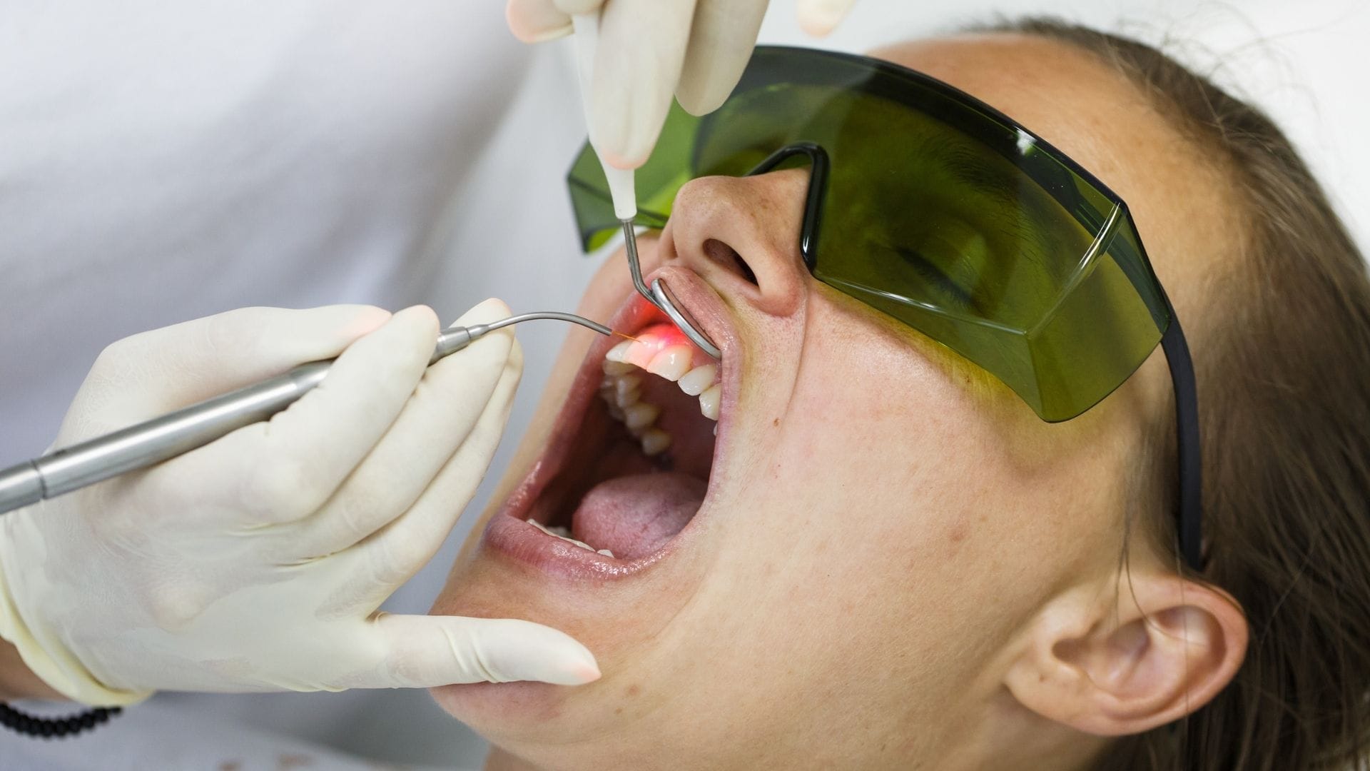 Dentist performing root scaling or root planing on patient with protective eyewear.