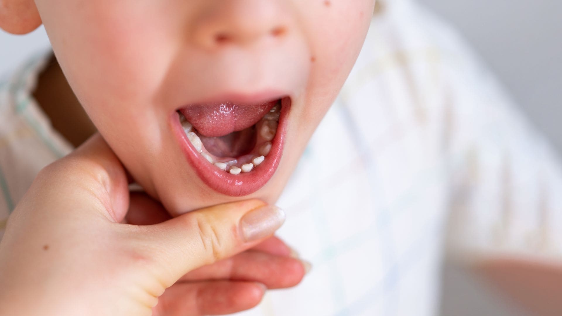 Close-up of a child's open mouth showing emerging teeth and a hand gently holding the chin.