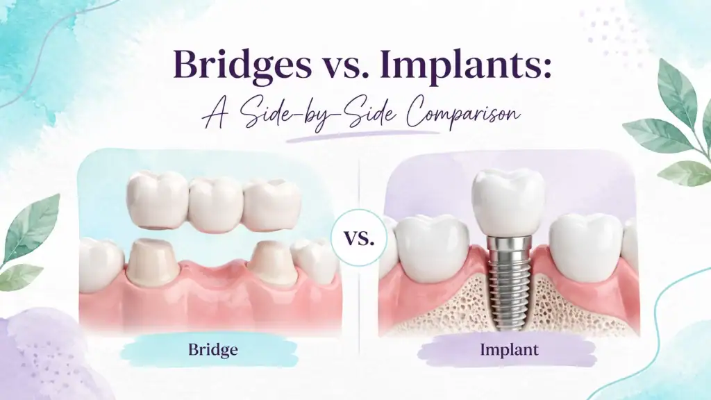 Comparison of dental bridges and implants for tooth replacement.